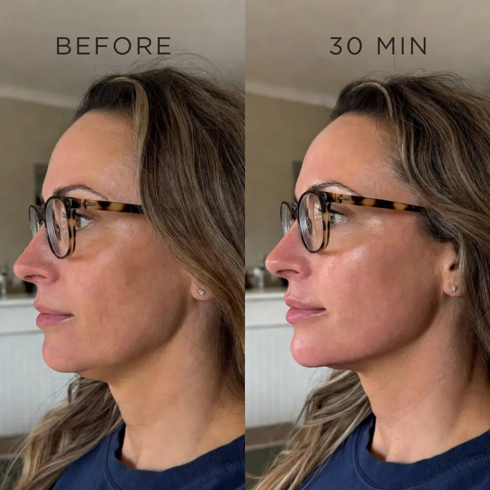 Ohlivo™ Cactox V-Lift Mask