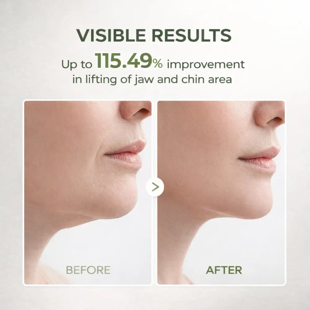 Ohlivo™ Cactox V-Lift Mask